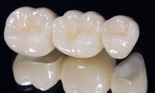 What are the main advantages of FCZ(Full Contour Zirconia）